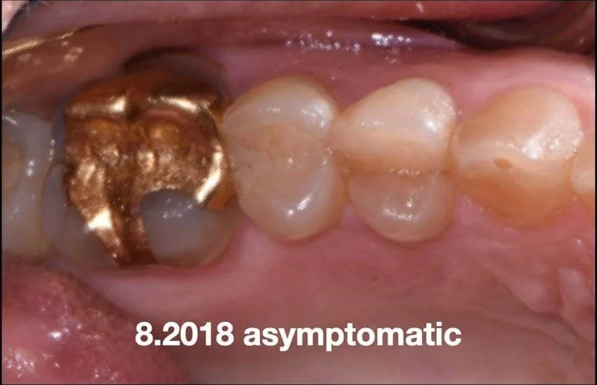 blog post image