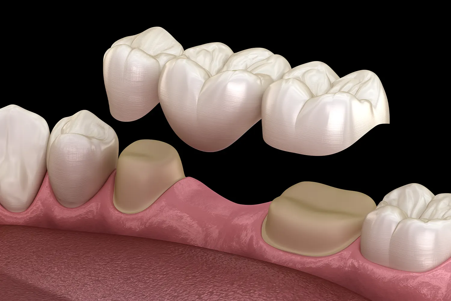 blog post image