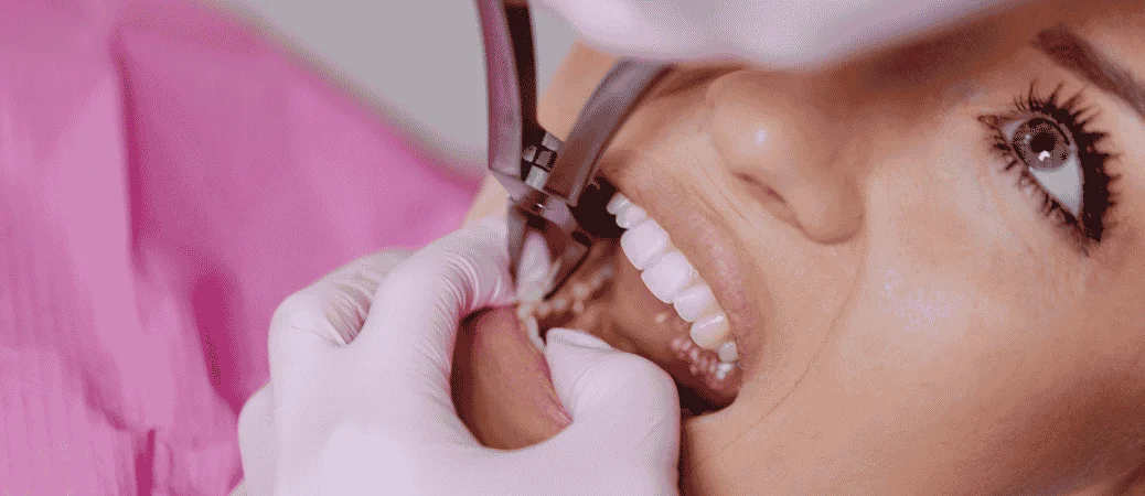 Tooth-extraction-and-advanced-procedures
