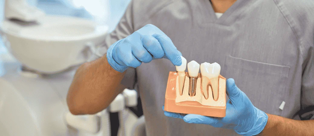 Dental Implant Recovery Week by Week: Timeline and Healing Tips