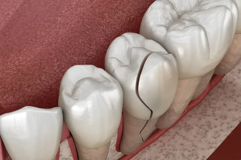Will the ER Pull a Tooth?