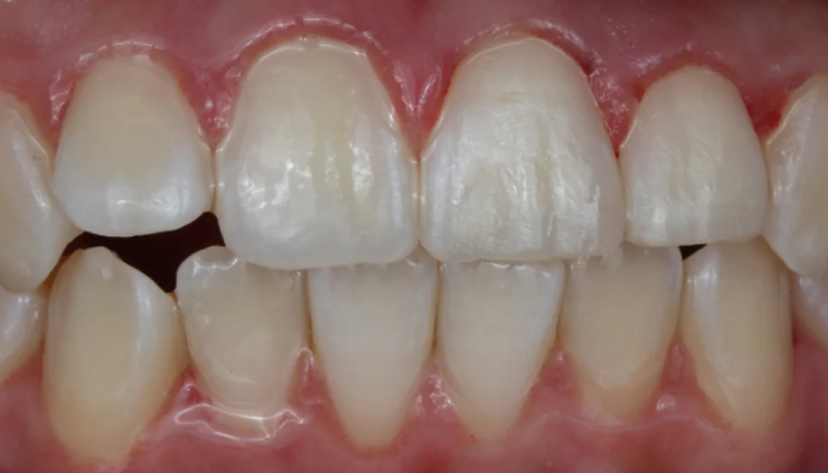 smile gallery 01 after