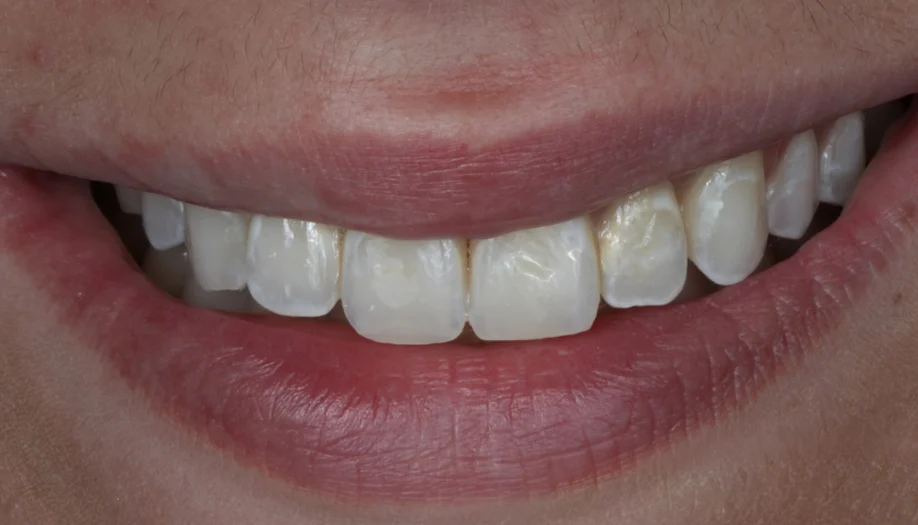 smile gallery 02 after