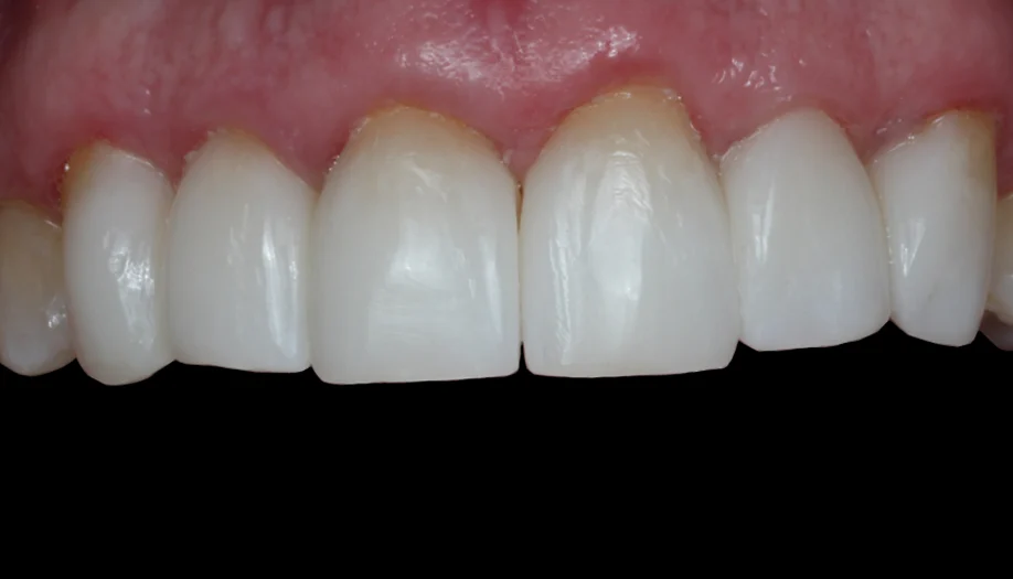 smile gallery 04 after