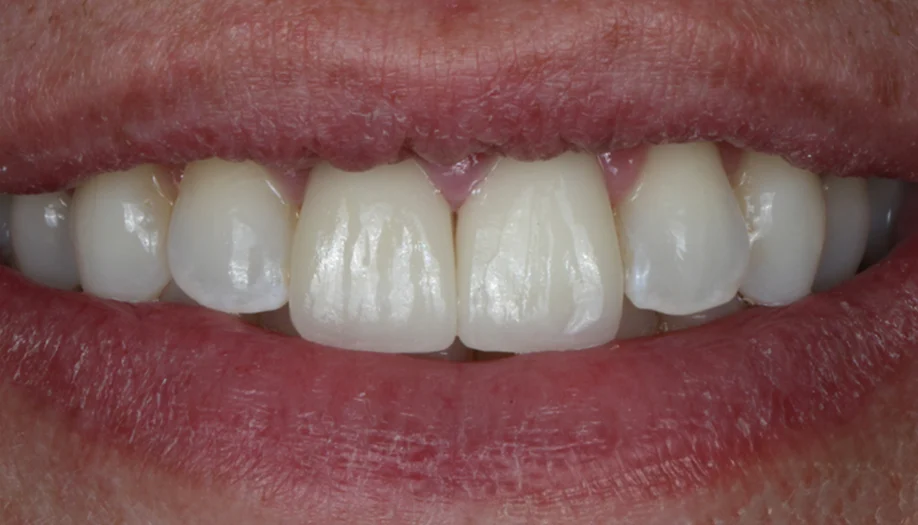 smile gallery 07 after