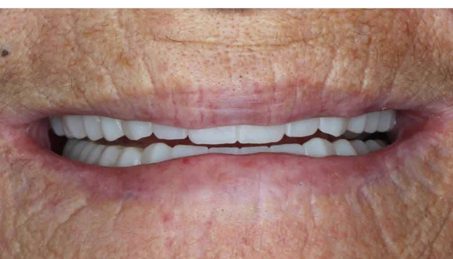 smile gallery 08 after