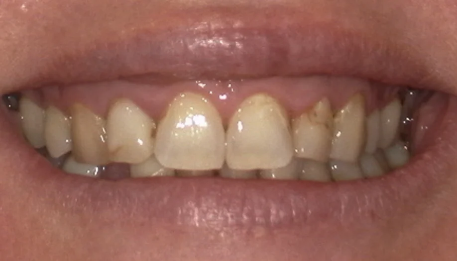 smile gallery 09 before