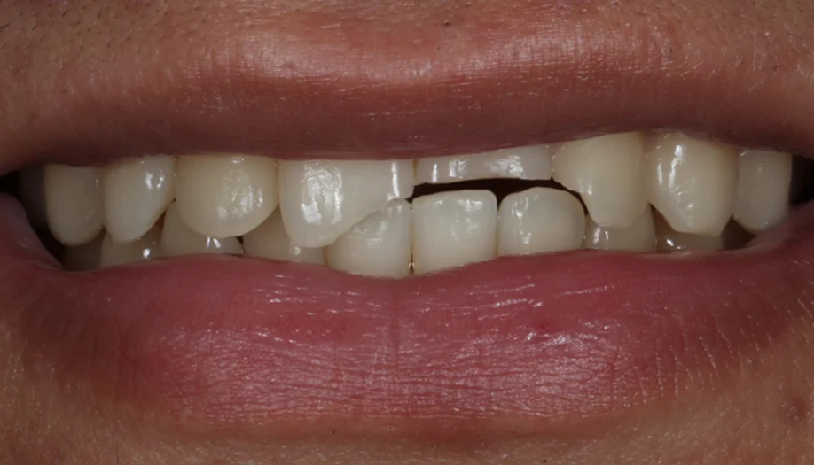 smile gallery 10 before