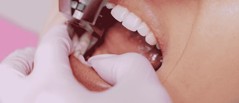 tooth extraction vs root canal