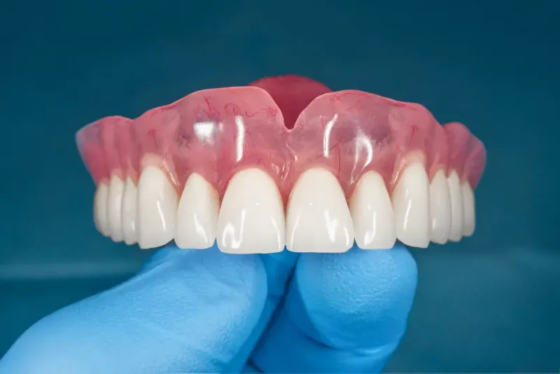 What Are Digital Dentures? A Modern Solution for a Confident Smile